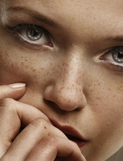 Le Maquillage Permanent du grain de beauté ou Éphélides